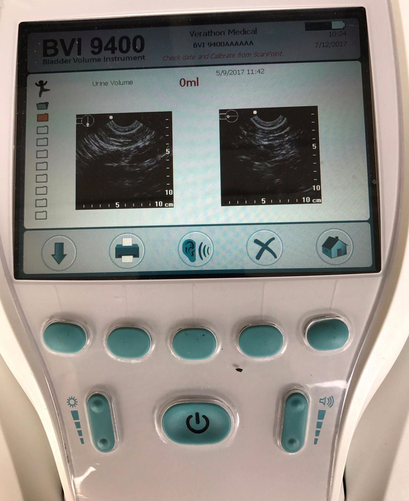 VERATHON BVI 9400 BLADDER VOLUME SCAN PORTABLE 3D ULTRASOUND WATCHVIDEO FREESHIP