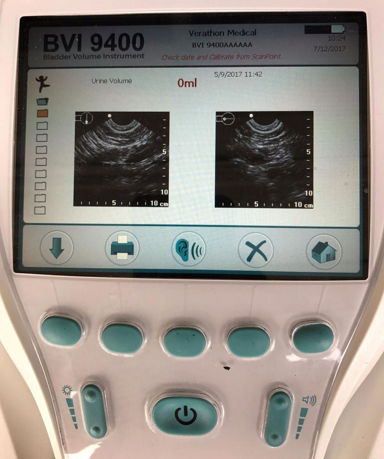 VERATHON BVI 9400 BLADDER VOLUME SCAN PORTABLE 3D ULTRASOUND WATCHVIDEO FREESHIP