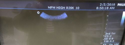 PHILIPS ENVISOR M2540A ULTRASOUND w/C5-2 PROBE HD11 CRT MONITOR MANUAL FREE SHIP