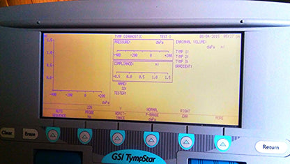 GSI TYMPSTAR MIDDLE EAR ANALYZER TYMPANOMETER GRASON STADLER w VALID CALIBRATION