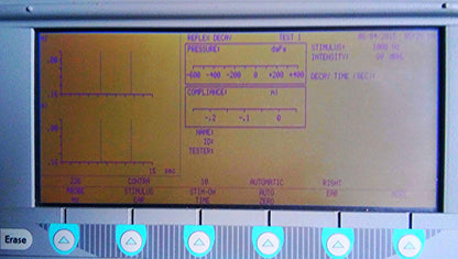 GSI TYMPSTAR MIDDLE EAR ANALYZER TYMPANOMETER GRASON STADLER w VALID CALIBRATION