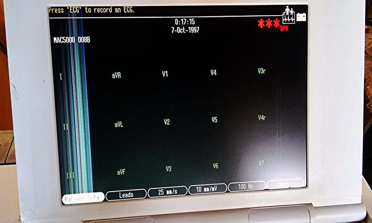 GE MARQUETTE MAC 5000 RESTING ECG EKG ANALYSIS SYSTEM CART