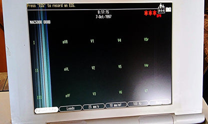GE MARQUETTE MAC 5000 RESTING ECG EKG ANALYSIS SYSTEM CART