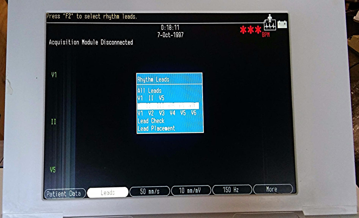 GE MARQUETTE MAC 5000 RESTING ECG EKG ANALYSIS SYSTEM CART