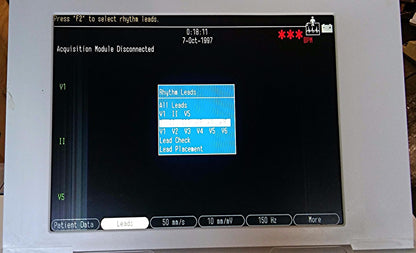 GE MARQUETTE MAC 5000 RESTING ECG EKG ANALYSIS SYSTEM CART