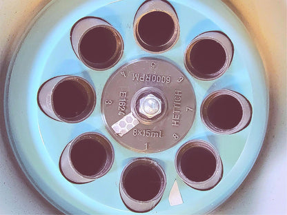 100% 90-DAY-WARRANTY HETTICH EBA 20 CENTRIFUGE E1624 ROTOR FREE SHIP WATCH VIDEO