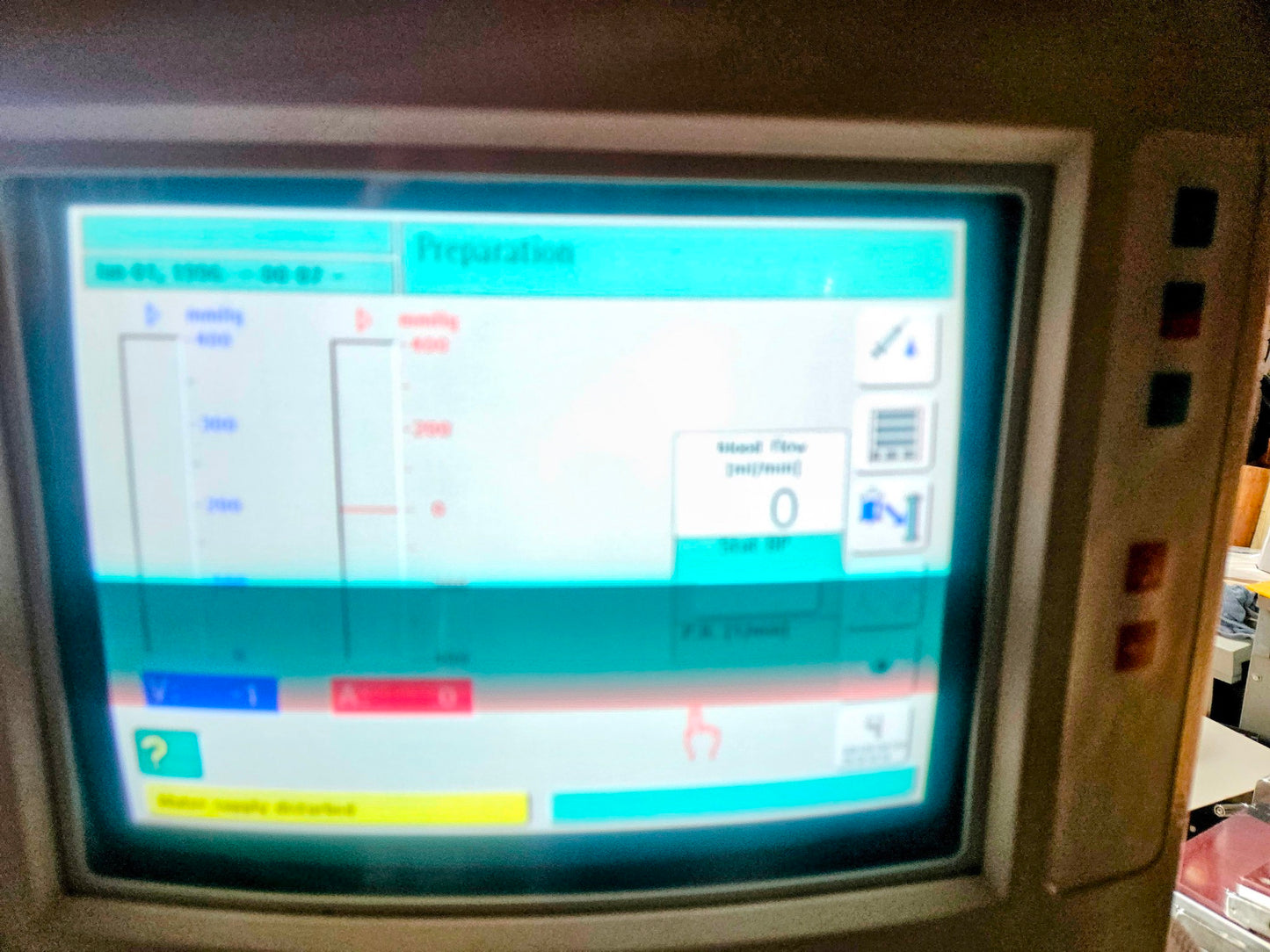 B BRAUN DIALOG+® CRRT HEMODIALYSIS MACHINE *SeemsToWorkFine* WATCHVIDEO FREESHIP