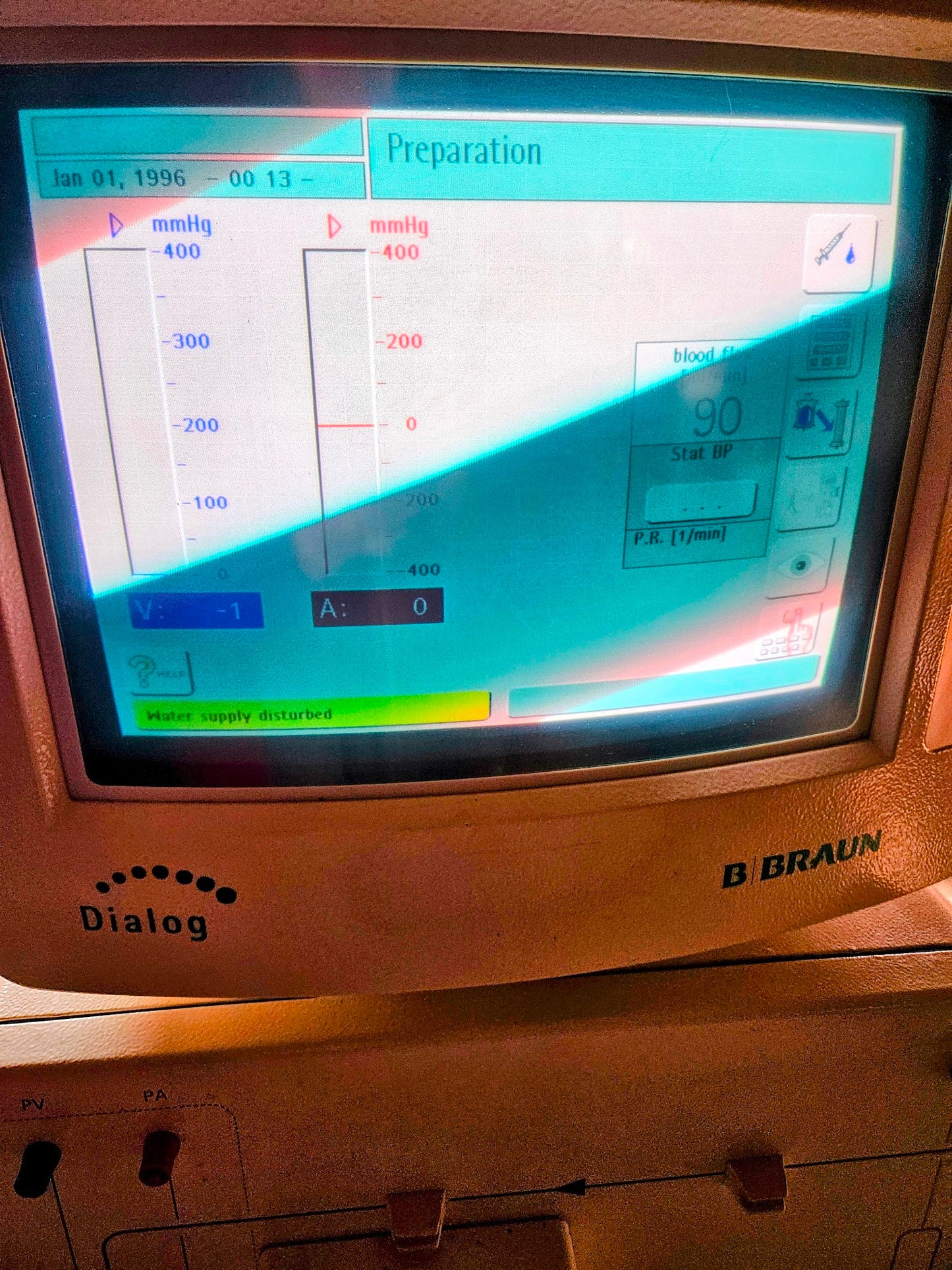 B BRAUN DIALOG+® CRRT HEMODIALYSIS MACHINE *SeemsToWorkFine* WATCHVIDEO FREESHIP