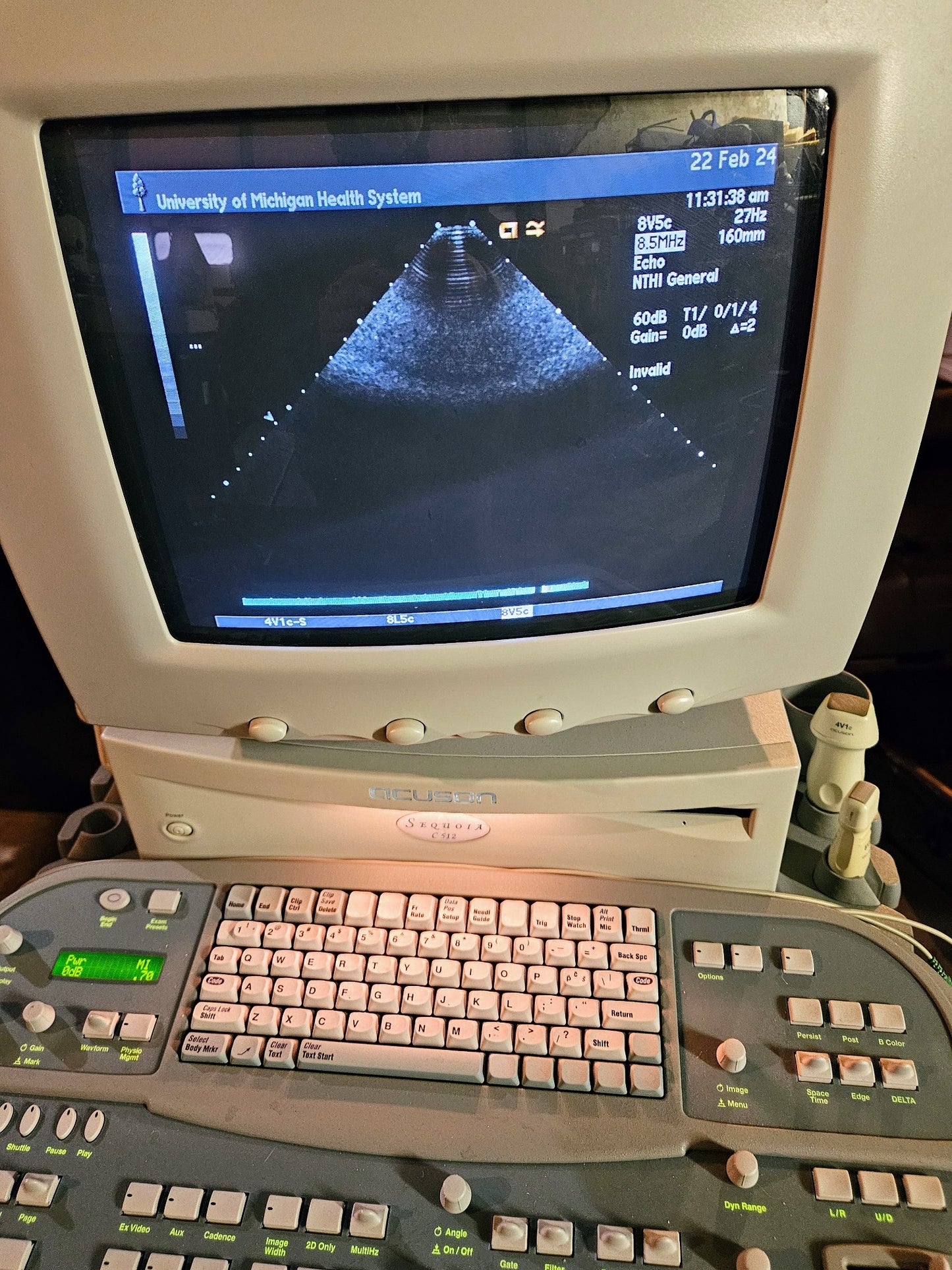 SIEMENS ACUSON SEQUOIA C512 ULTRASOUND 4 PROBES & EXTRA 90DAYWARRANTY WATCHVIDEO