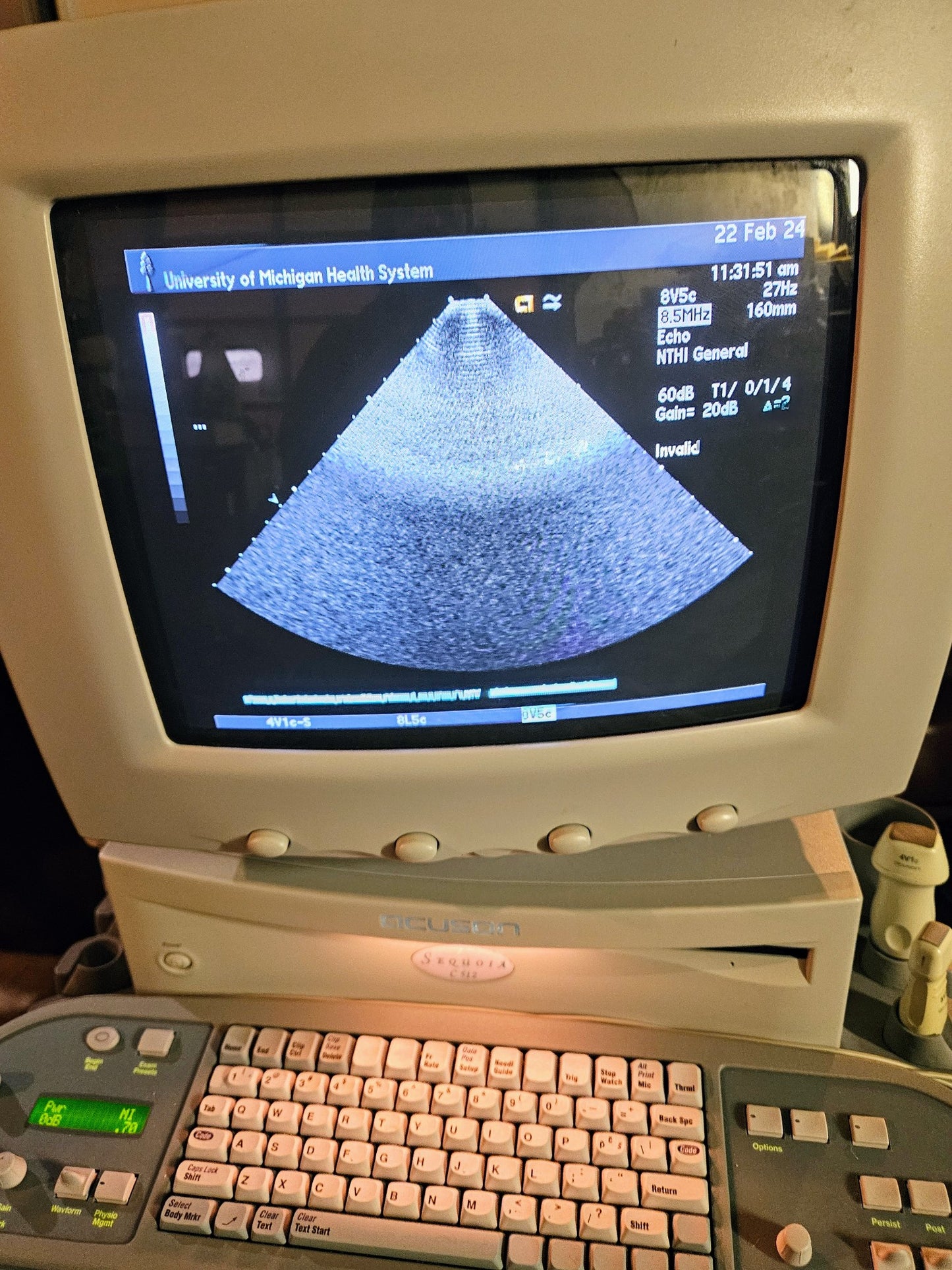 SIEMENS ACUSON SEQUOIA C512 ULTRASOUND 4 PROBES & EXTRA 90DAYWARRANTY WATCHVIDEO