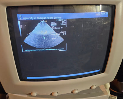 SIEMENS ACUSON SEQUOIA C512 ULTRASOUND 4 PROBES & EXTRA 90DAYWARRANTY WATCHVIDEO