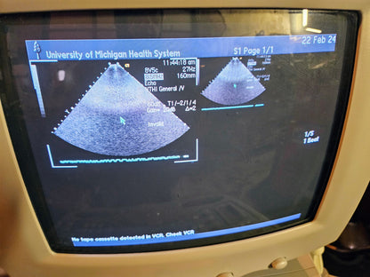SIEMENS ACUSON SEQUOIA C512 ULTRASOUND 4 PROBES & EXTRA 90DAYWARRANTY WATCHVIDEO