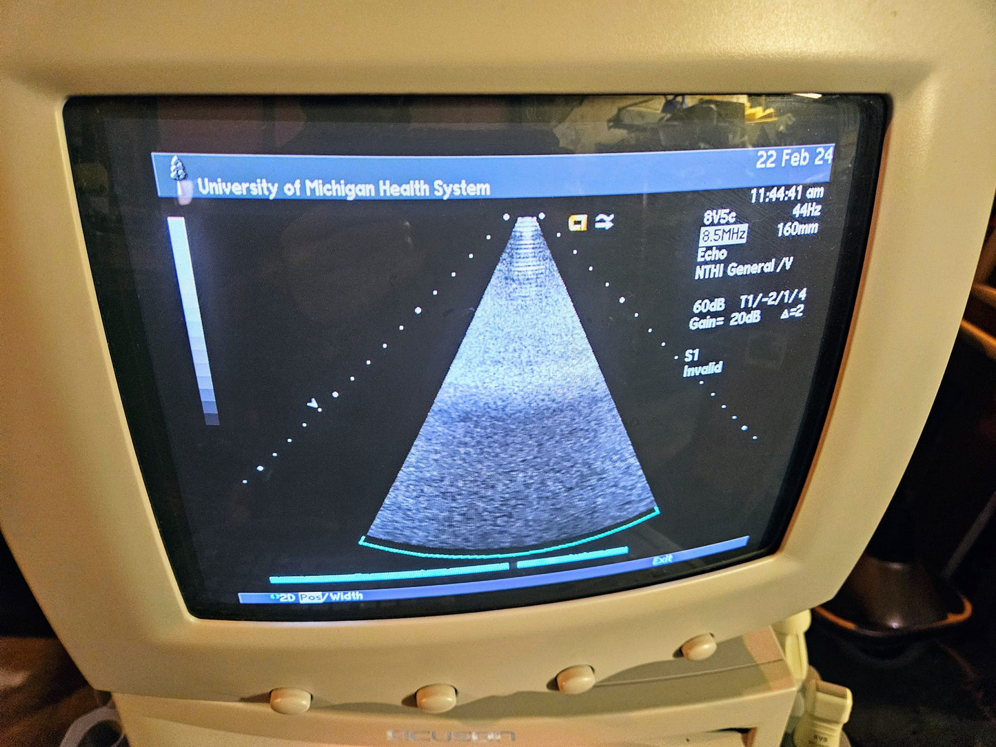 SIEMENS ACUSON SEQUOIA C512 ULTRASOUND 4 PROBES & EXTRA 90DAYWARRANTY WATCHVIDEO