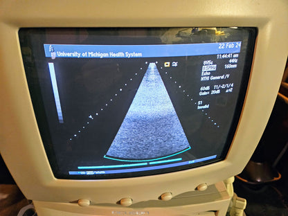 SIEMENS ACUSON SEQUOIA C512 ULTRASOUND 4 PROBES & EXTRA 90DAYWARRANTY WATCHVIDEO