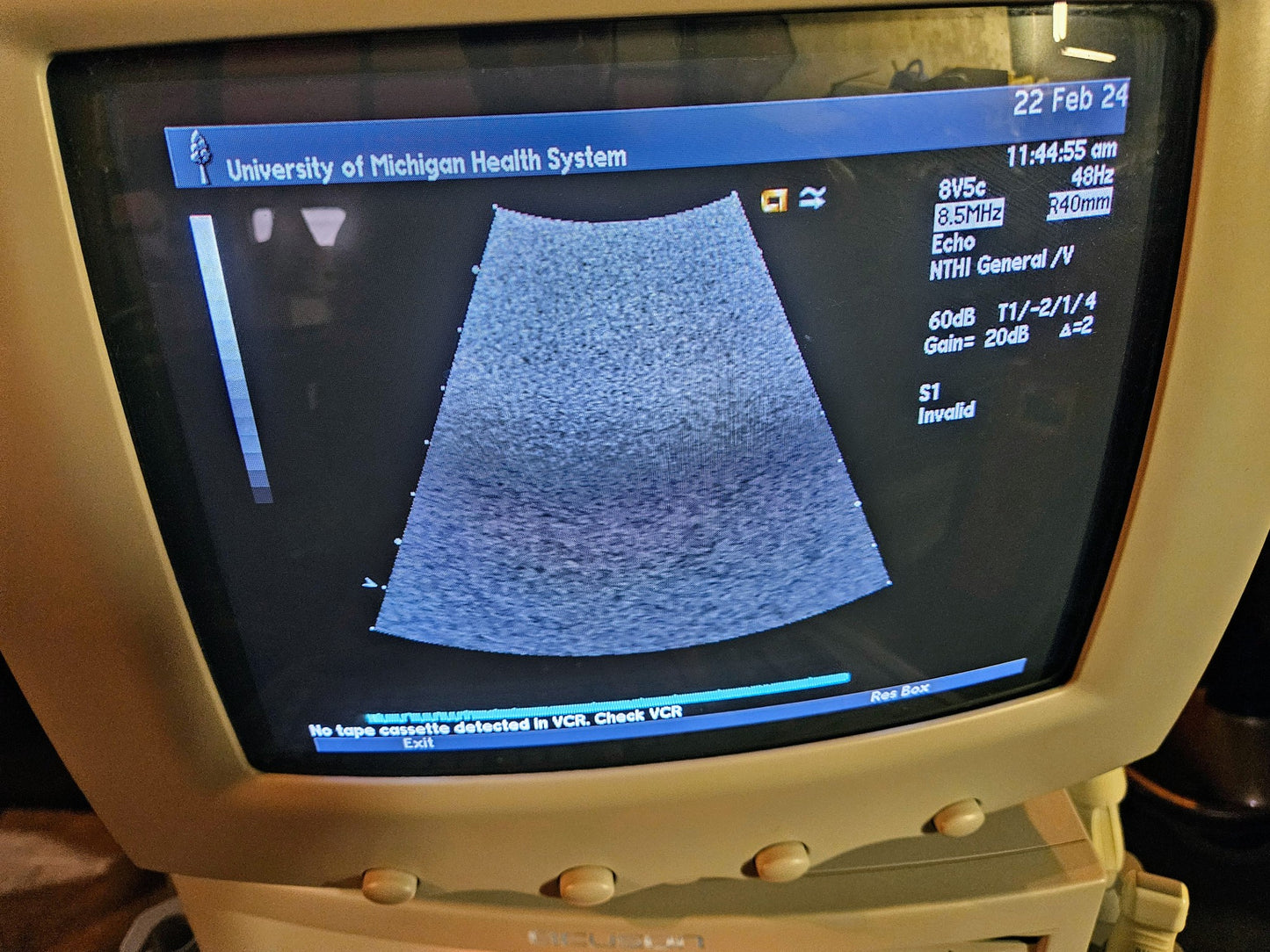 SIEMENS ACUSON SEQUOIA C512 ULTRASOUND 4 PROBES & EXTRA 90DAYWARRANTY WATCHVIDEO