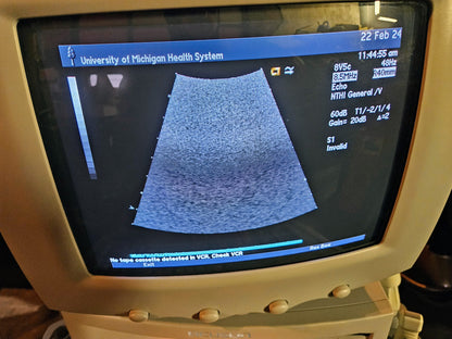 SIEMENS ACUSON SEQUOIA C512 ULTRASOUND 4 PROBES & EXTRA 90DAYWARRANTY WATCHVIDEO