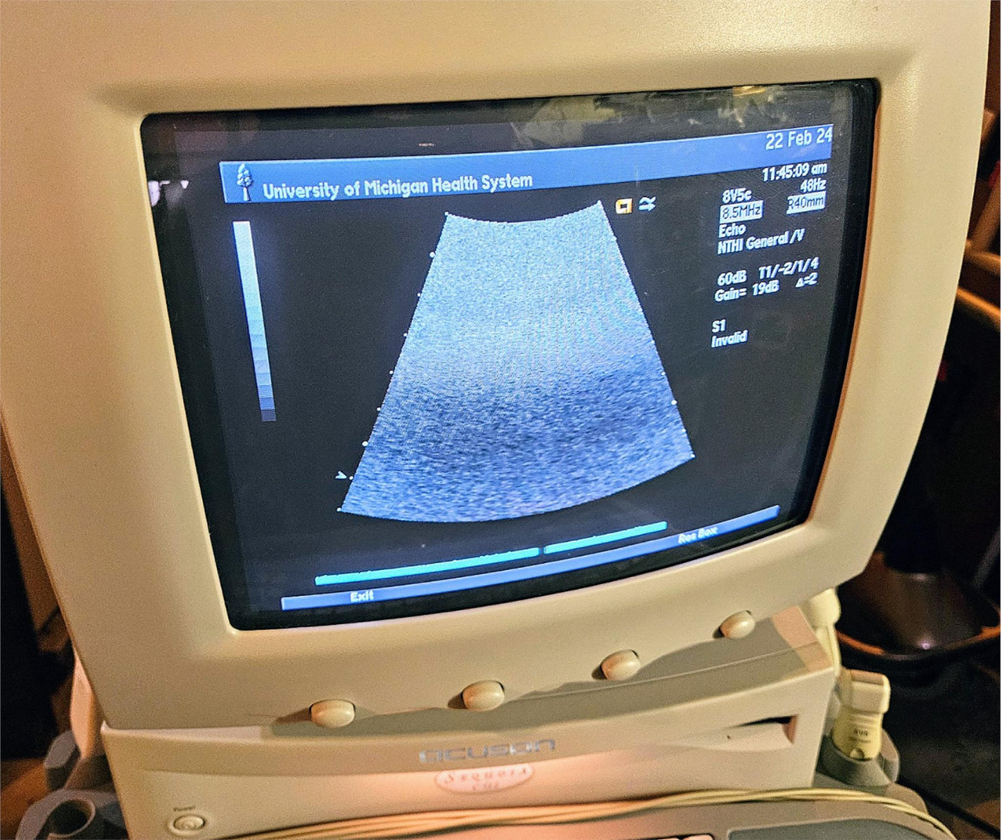 SIEMENS ACUSON SEQUOIA C512 ULTRASOUND 4 PROBES & EXTRA 90DAYWARRANTY WATCHVIDEO