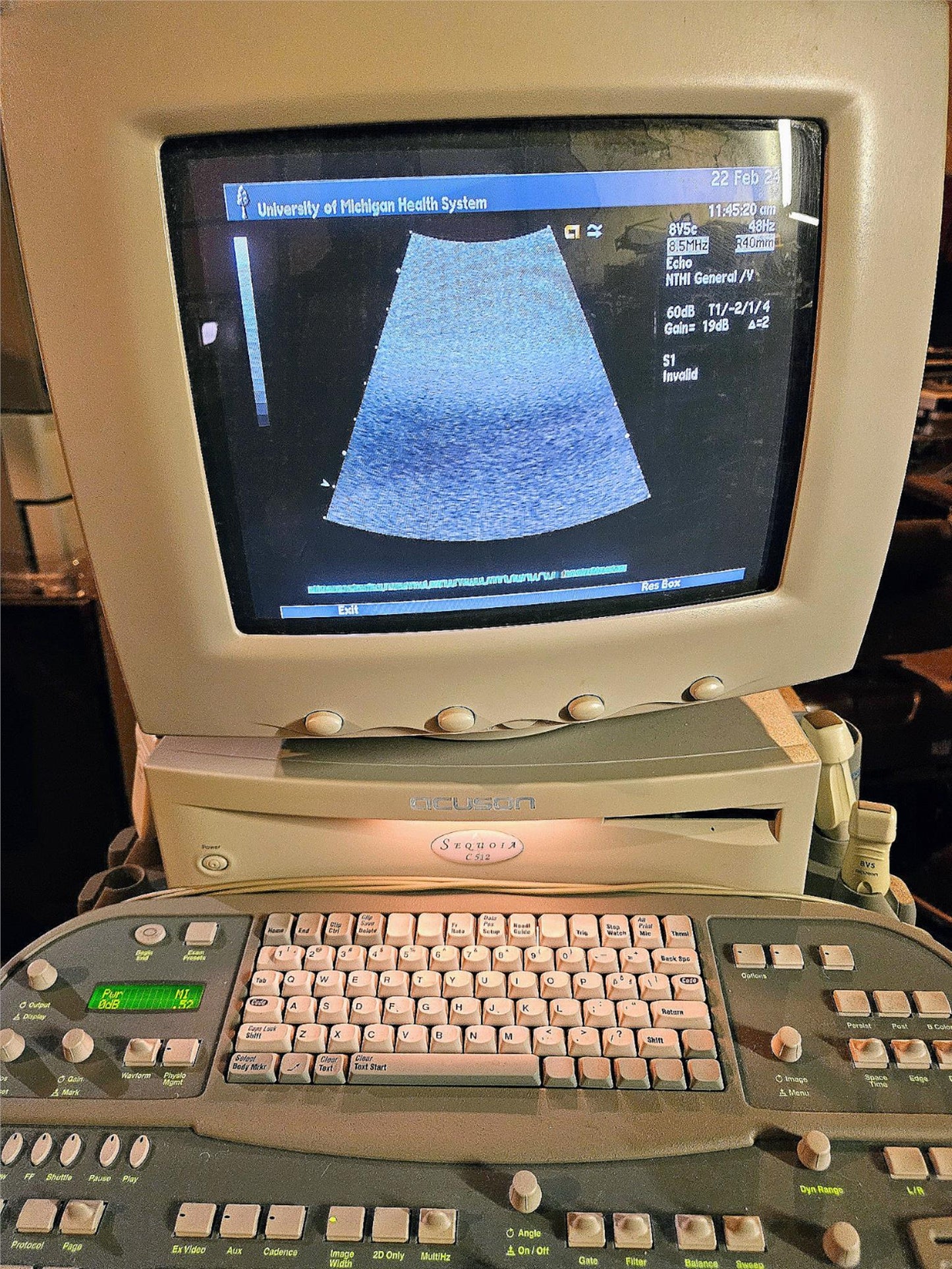 SIEMENS ACUSON SEQUOIA C512 ULTRASOUND 4 PROBES & EXTRA 90DAYWARRANTY WATCHVIDEO