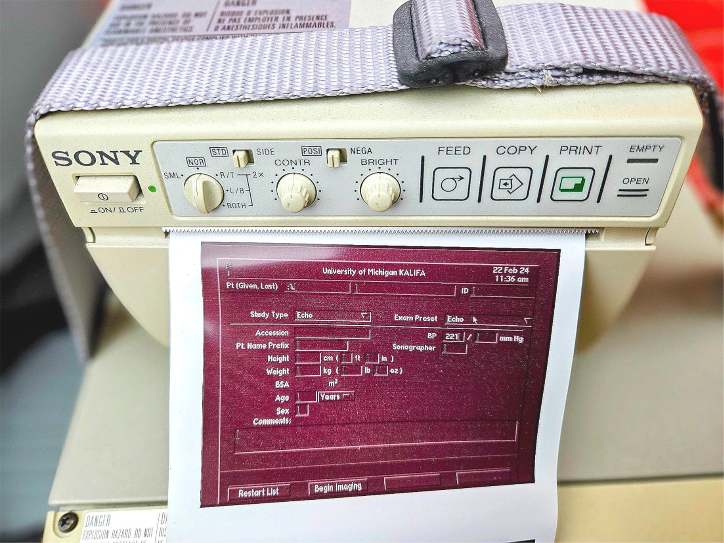SIEMENS ACUSON SEQUOIA C512 ULTRASOUND 4 PROBES & EXTRA 90DAYWARRANTY WATCHVIDEO