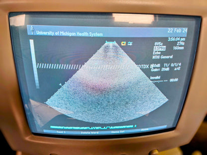 SIEMENS ACUSON SEQUOIA C512 ULTRASOUND 4 PROBES & EXTRA 90DAYWARRANTY WATCHVIDEO