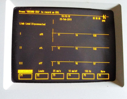 MARQUETTE MAC VU EKG EKG ECG Machine - 12LEAD INTERPRETIVE with MANUAL