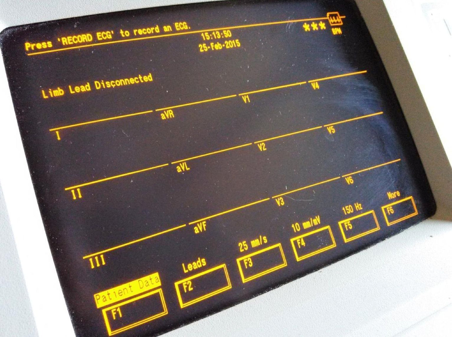 MARQUETTE MAC VU EKG EKG ECG Machine - 12LEAD INTERPRETIVE with MANUAL