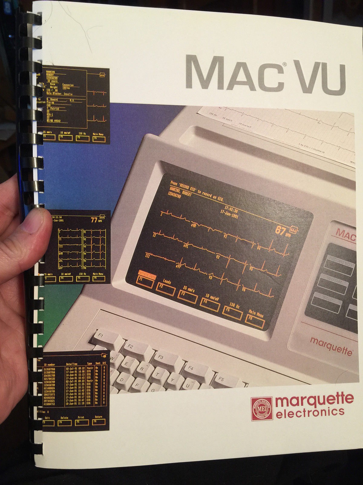 MARQUETTE MAC VU EKG EKG ECG Machine - 12LEAD INTERPRETIVE with MANUAL
