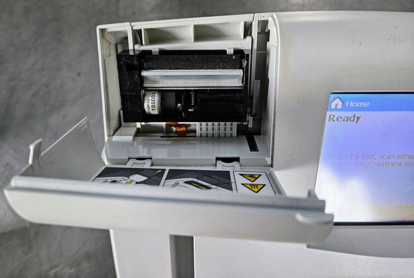 SIEMENS DCA VANTAGE ANALYZER® DIABETES GLYCEMIC CONTROL URINE MONITOR FREESHIP