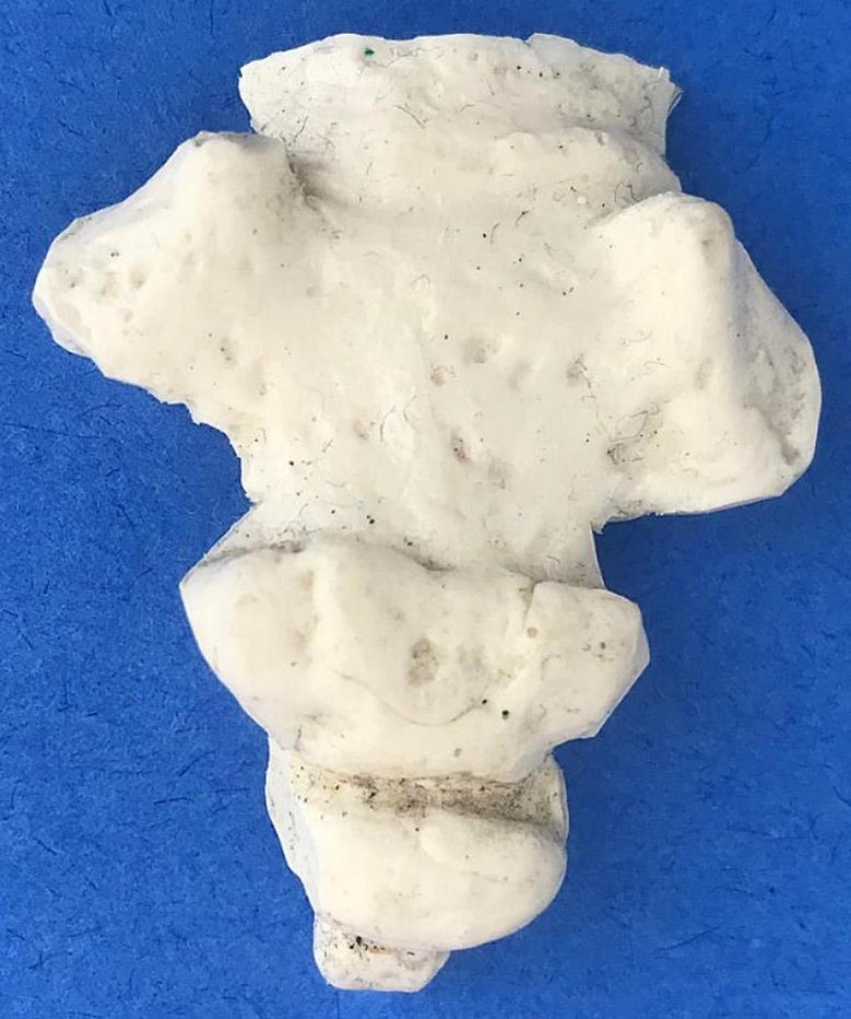 LOT of Medical Plastics Lumbar Vertebrae Spine Spinal Column Hand Feet FREE SHIP