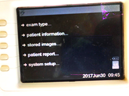 SONOVISION SONOHEART C15/4-2MHZ TRANSDUCER HAND ELECTROCARDIOGRAPHY WATCH VIDEO