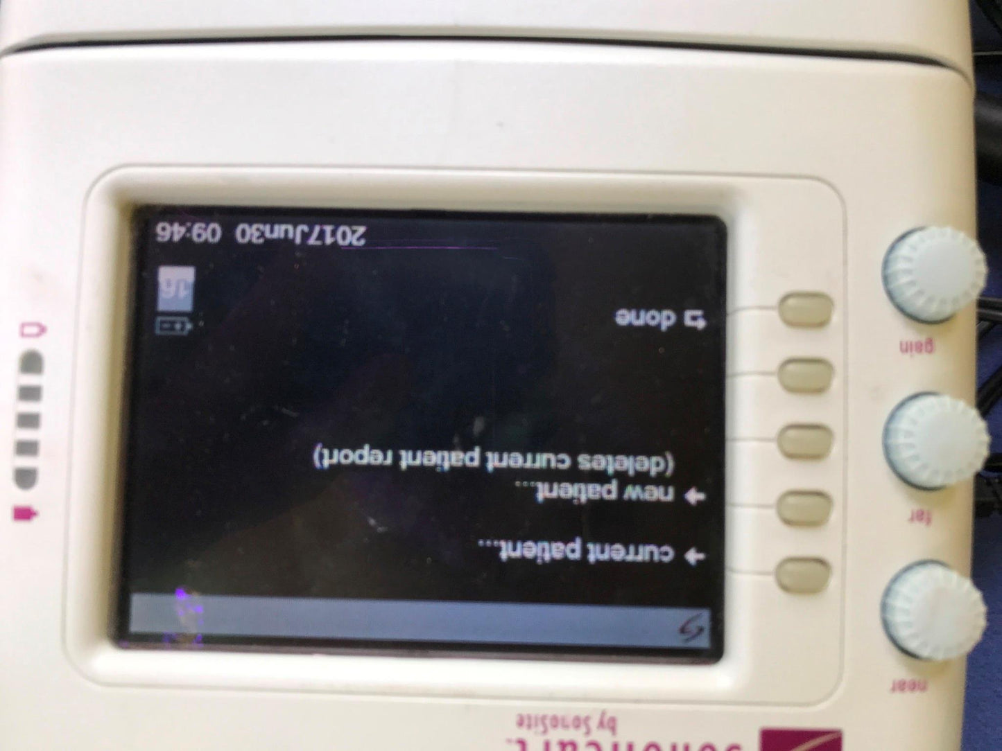 SONOVISION SONOHEART C15/4-2MHZ TRANSDUCER HAND ELECTROCARDIOGRAPHY WATCH VIDEO