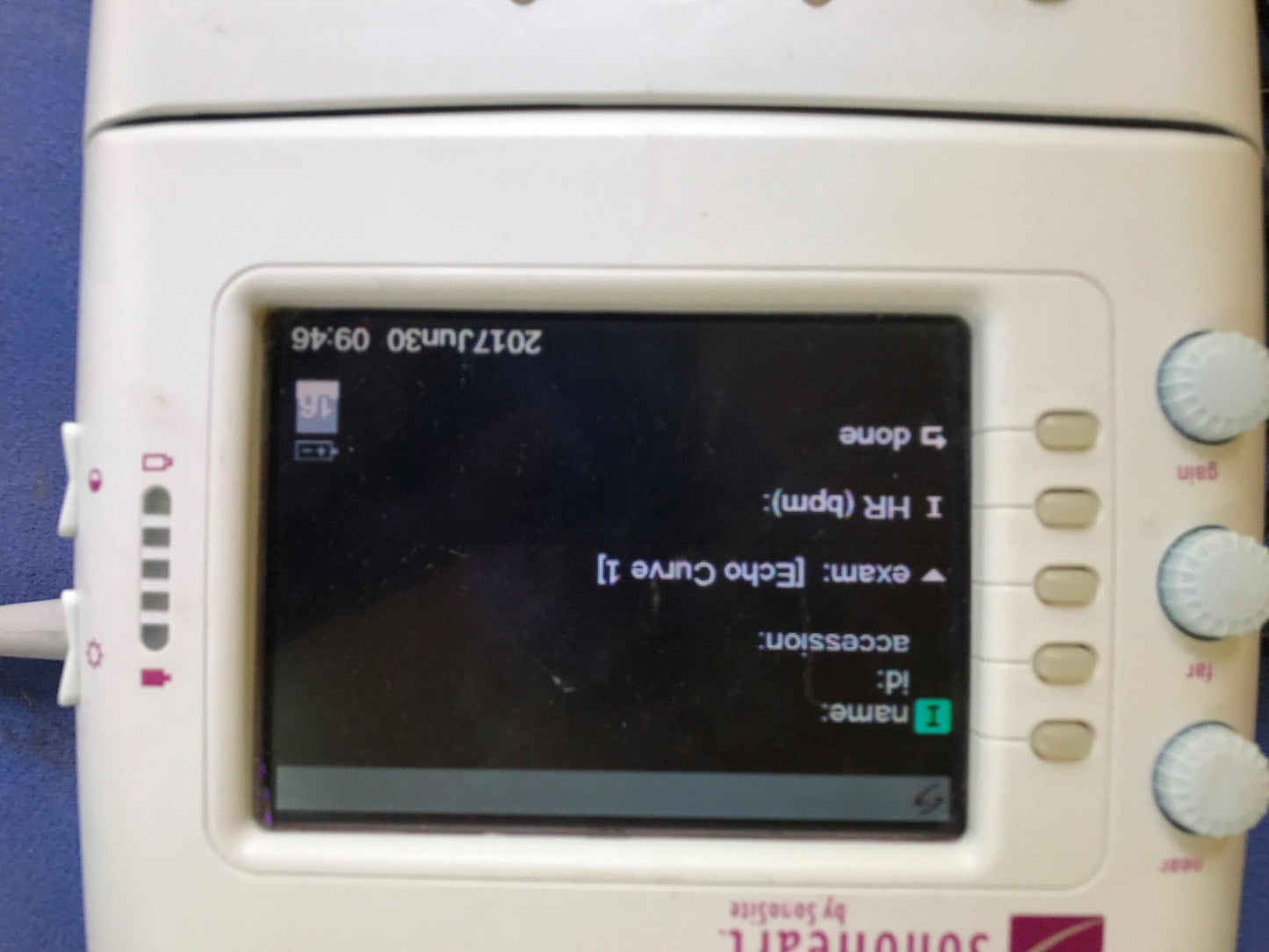 SONOVISION SONOHEART C15/4-2MHZ TRANSDUCER HAND ELECTROCARDIOGRAPHY WATCH VIDEO