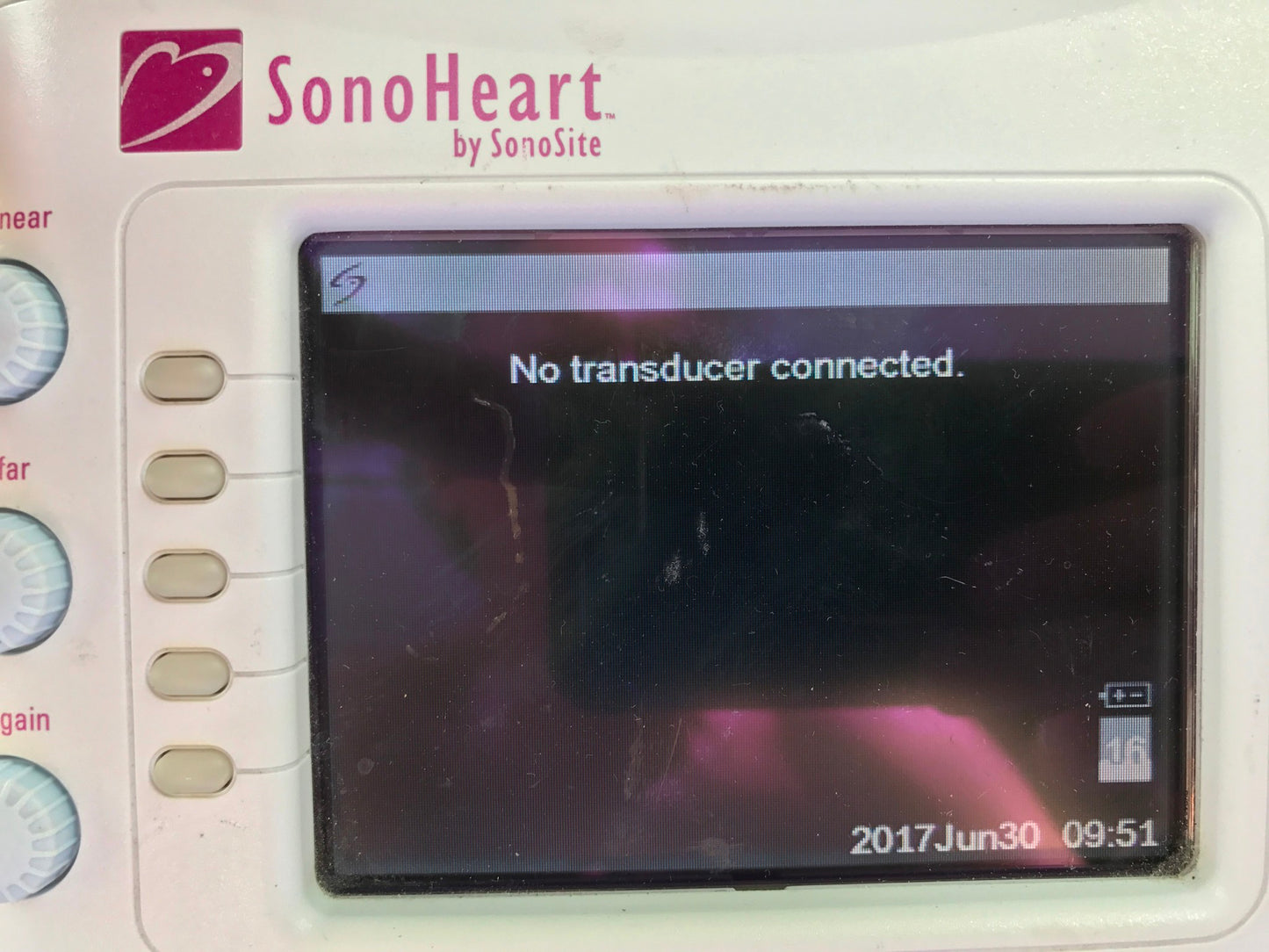 SONOVISION SONOHEART C15/4-2MHZ TRANSDUCER HAND ELECTROCARDIOGRAPHY WATCH VIDEO