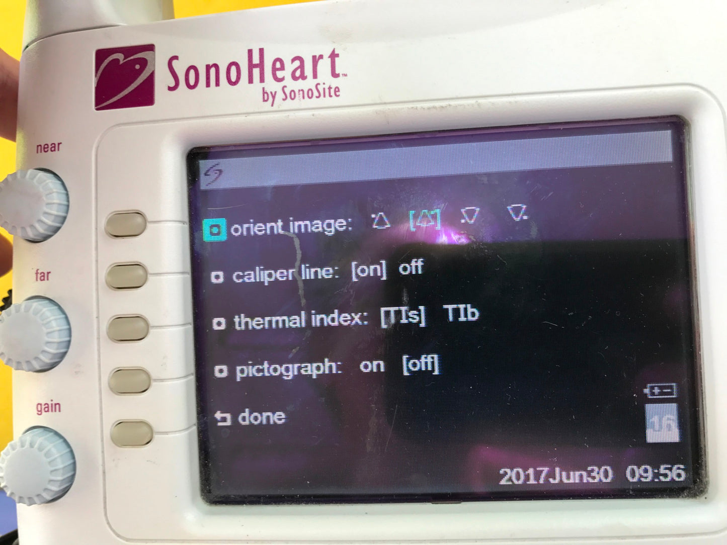 SONOVISION SONOHEART C15/4-2MHZ TRANSDUCER HAND ELECTROCARDIOGRAPHY WATCH VIDEO