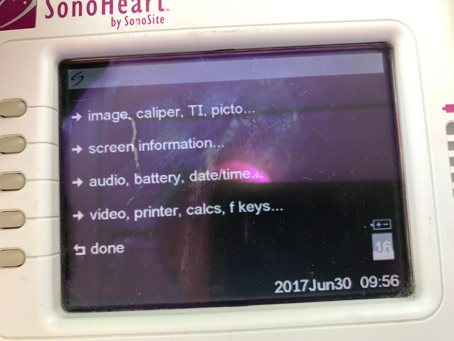 SONOVISION SONOHEART C15/4-2MHZ TRANSDUCER HAND ELECTROCARDIOGRAPHY WATCH VIDEO