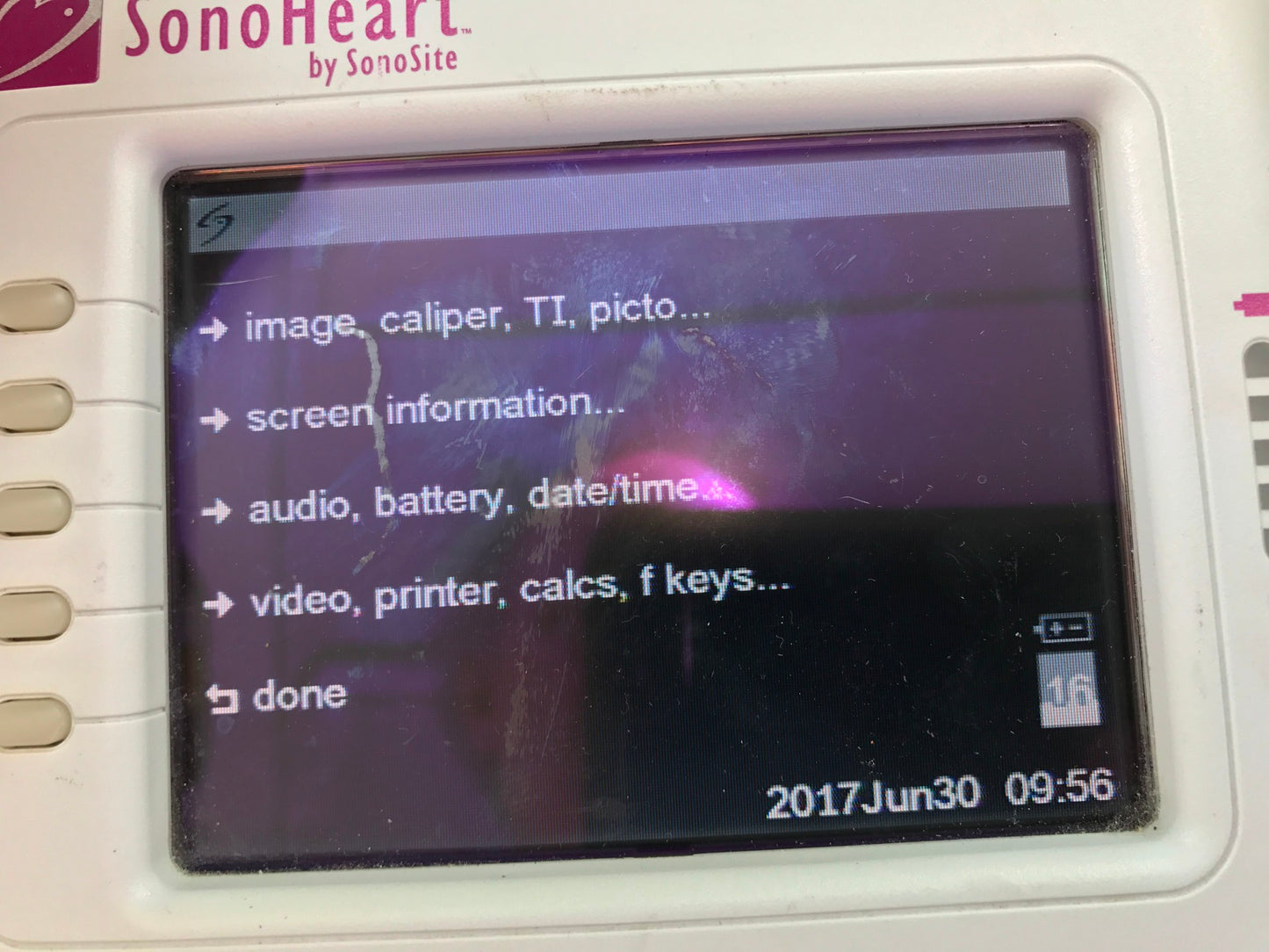 SONOVISION SONOHEART C15/4-2MHZ TRANSDUCER HAND ELECTROCARDIOGRAPHY WATCH VIDEO