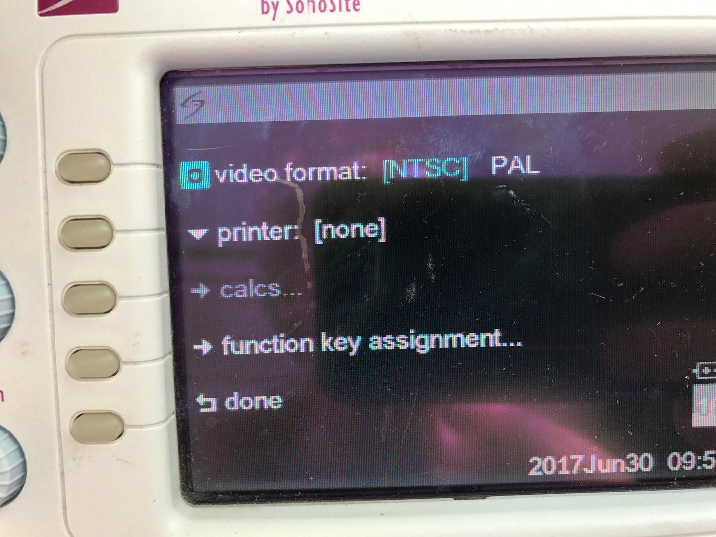 SONOVISION SONOHEART C15/4-2MHZ TRANSDUCER HAND ELECTROCARDIOGRAPHY WATCH VIDEO