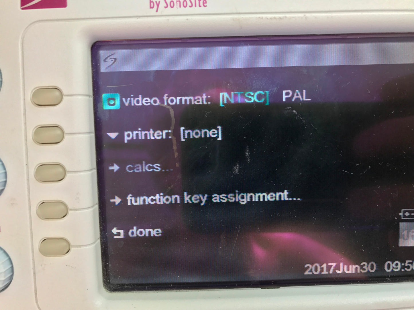 SONOVISION SONOHEART C15/4-2MHZ TRANSDUCER HAND ELECTROCARDIOGRAPHY WATCH VIDEO