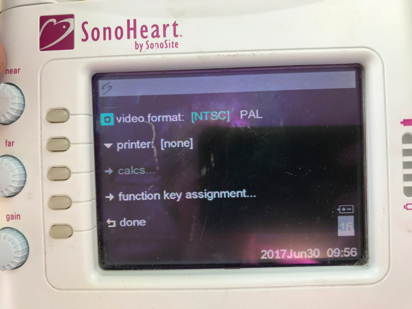 SONOVISION SONOHEART C15/4-2MHZ TRANSDUCER HAND ELECTROCARDIOGRAPHY WATCH VIDEO