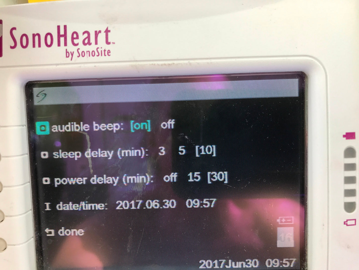 SONOVISION SONOHEART C15/4-2MHZ TRANSDUCER HAND ELECTROCARDIOGRAPHY WATCH VIDEO