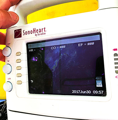 SONOVISION SONOHEART C15/4-2MHZ TRANSDUCER HAND ELECTROCARDIOGRAPHY WATCH VIDEO