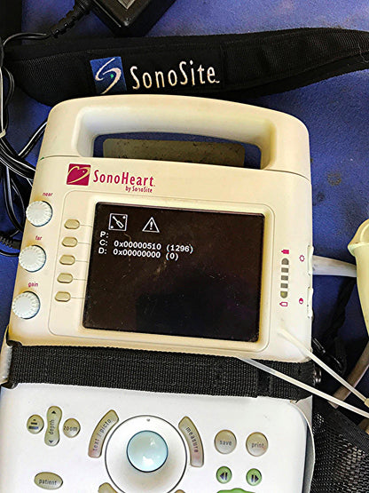 SONOVISION SONOHEART C15/4-2MHZ TRANSDUCER HAND ELECTROCARDIOGRAPHY WATCH VIDEO