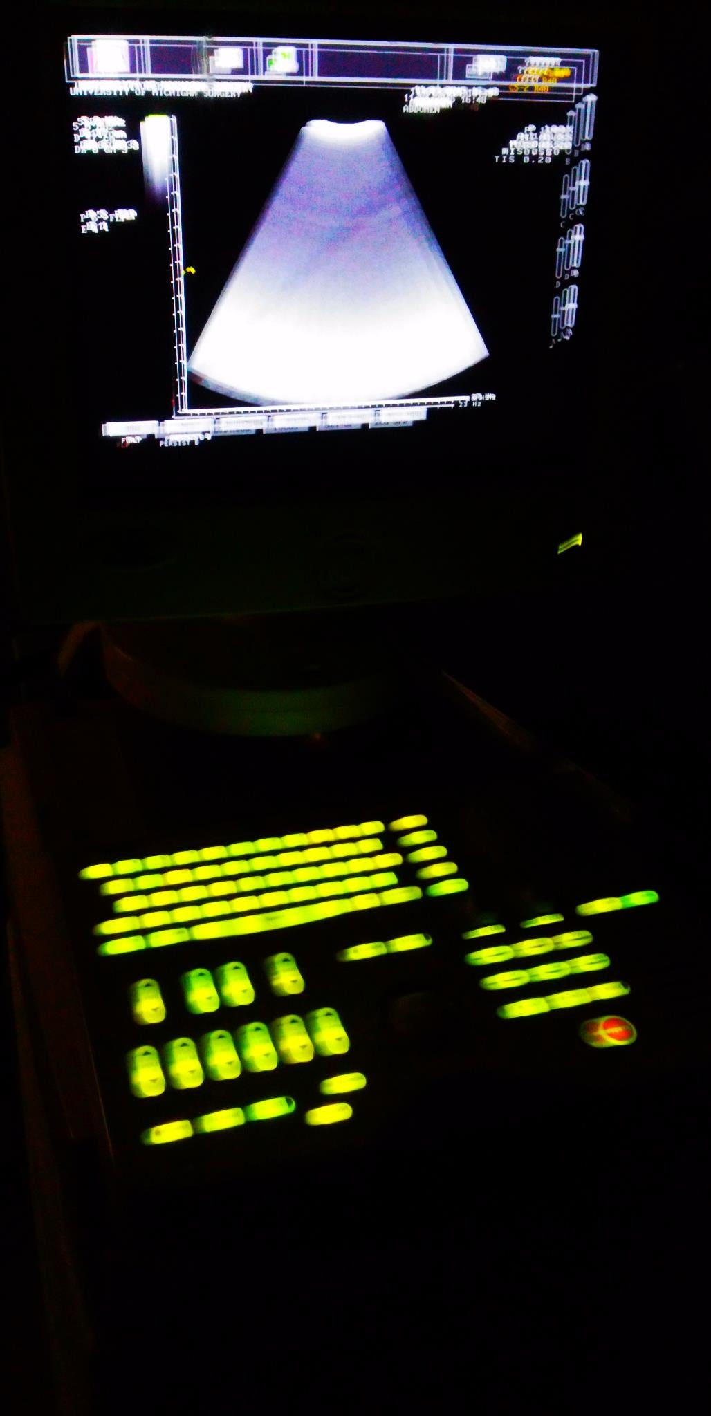 PICUS CRII ESAOTE PIE MED 410670 ULTRASOUND C5-2 R40 & LA523 PROBE SONY UP-895MD