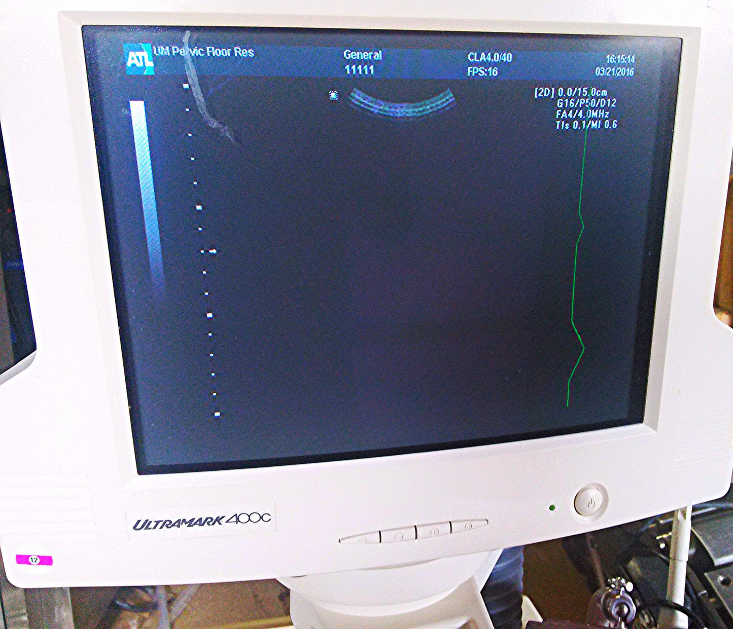 ULTRAMARK 400C ULTRASOUND PHILIPS 4.0 40mm PROBE MITSUBISHI P91 PRINTER CART