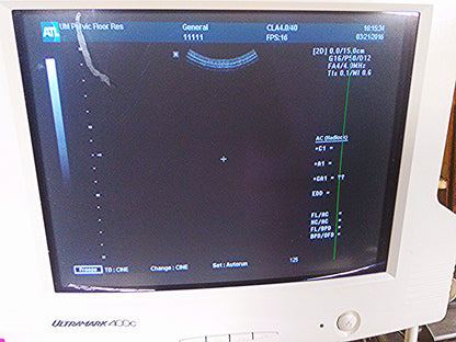 ATL ULTRAMARK 400C ULTRASOUND PHILIPS 4.0 40mm PROBE MITSUBISHI P91 PRINTER CART