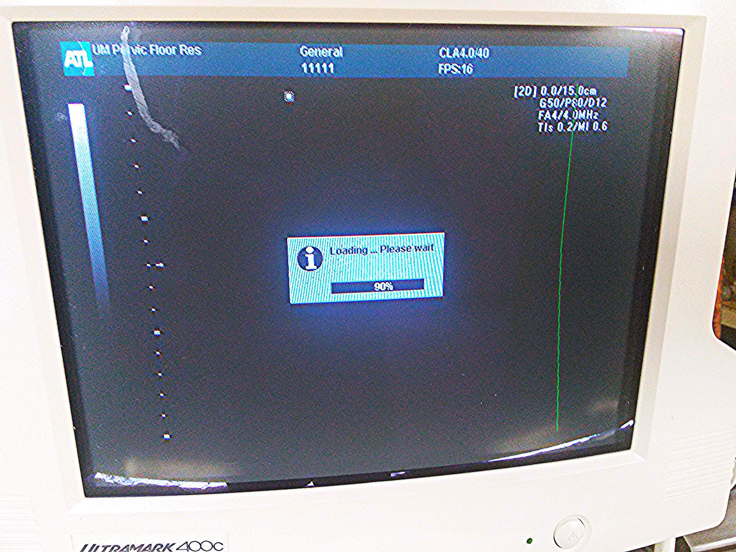 ATL ULTRAMARK 400C ULTRASOUND PHILIPS 4.0 40mm PROBE MITSUBISHI P91 PRINTER CART