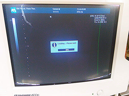 ULTRAMARK 400C ULTRASOUND PHILIPS 4.0 40mm PROBE MITSUBISHI P91 PRINTER CART