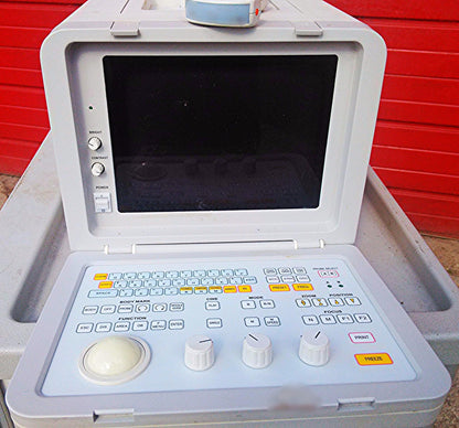 SIUI CTS-485 PORTABLE ULTRASOUND ULTRASONIC DIAGNOSTIC INSTRUMET 3.5 PROBE C3I40