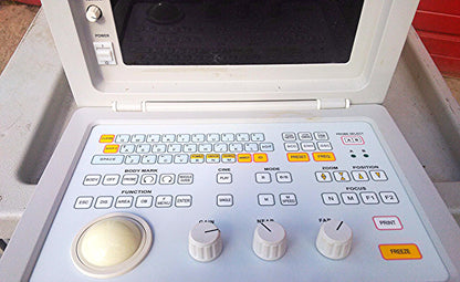 SIUI CTS-485 PORTABLE ULTRASOUND ULTRASONIC DIAGNOSTIC INSTRUMET 3.5 PROBE C3I40