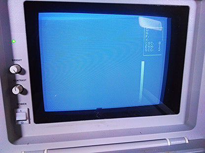 SIUI CTS-485 PORTABLE ULTRASOUND ULTRASONIC DIAGNOSTIC INSTRUMET 3.5 PROBE C3I40